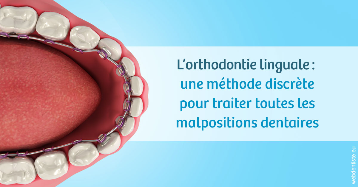 https://dr-ahr-catherine.chirurgiens-dentistes.fr/L'orthodontie linguale 1