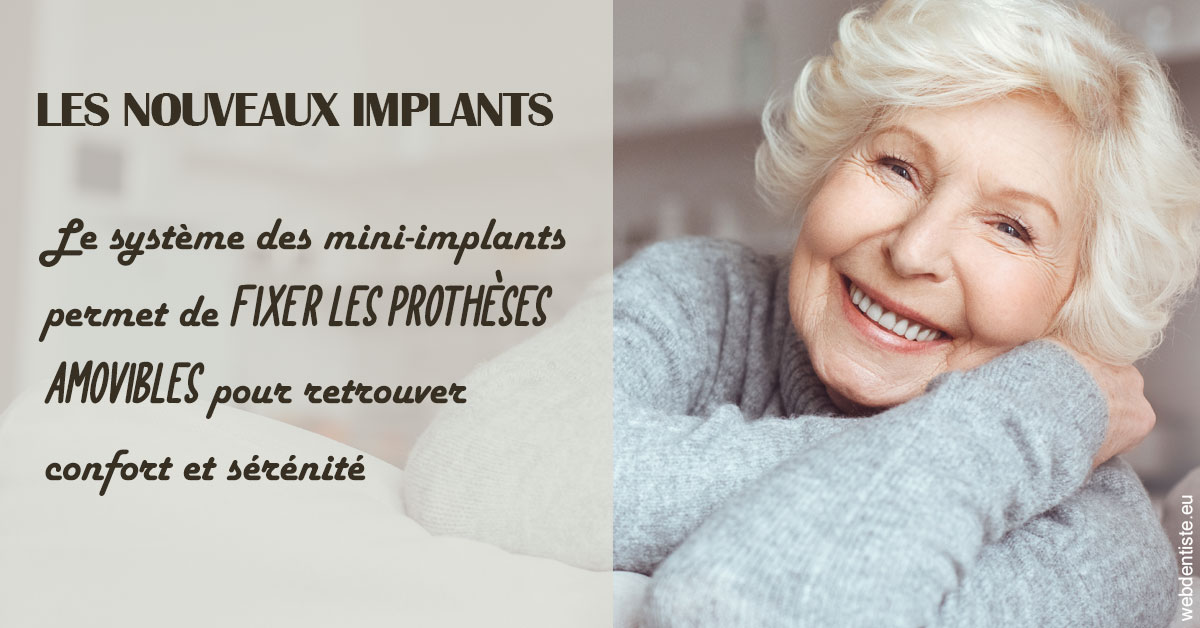 https://dr-ahr-catherine.chirurgiens-dentistes.fr/Les nouveaux implants 1
