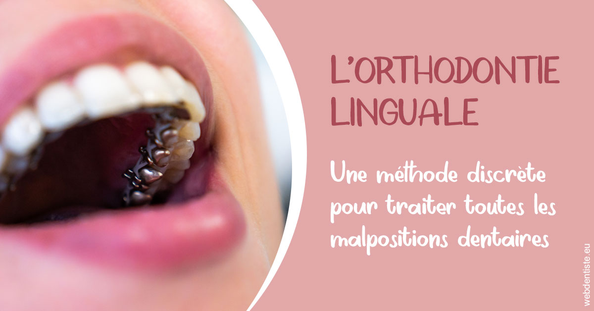 https://dr-ahr-catherine.chirurgiens-dentistes.fr/L'orthodontie linguale 2