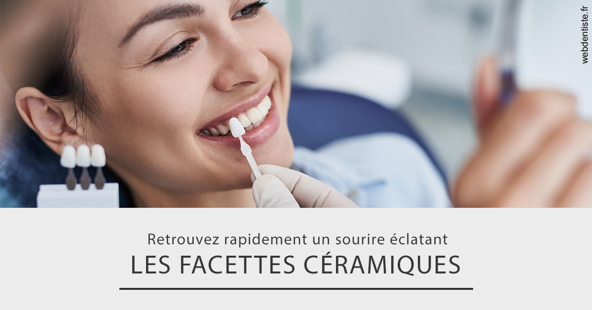 https://dr-ahr-catherine.chirurgiens-dentistes.fr/Les facettes céramiques 2