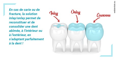 https://dr-ahr-catherine.chirurgiens-dentistes.fr/L'INLAY ou l'ONLAY