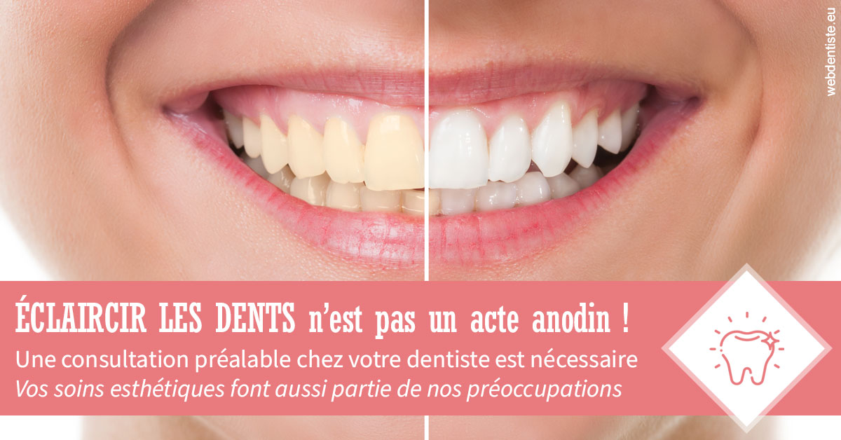 https://dr-ahr-catherine.chirurgiens-dentistes.fr/Eclaircir les dents 1