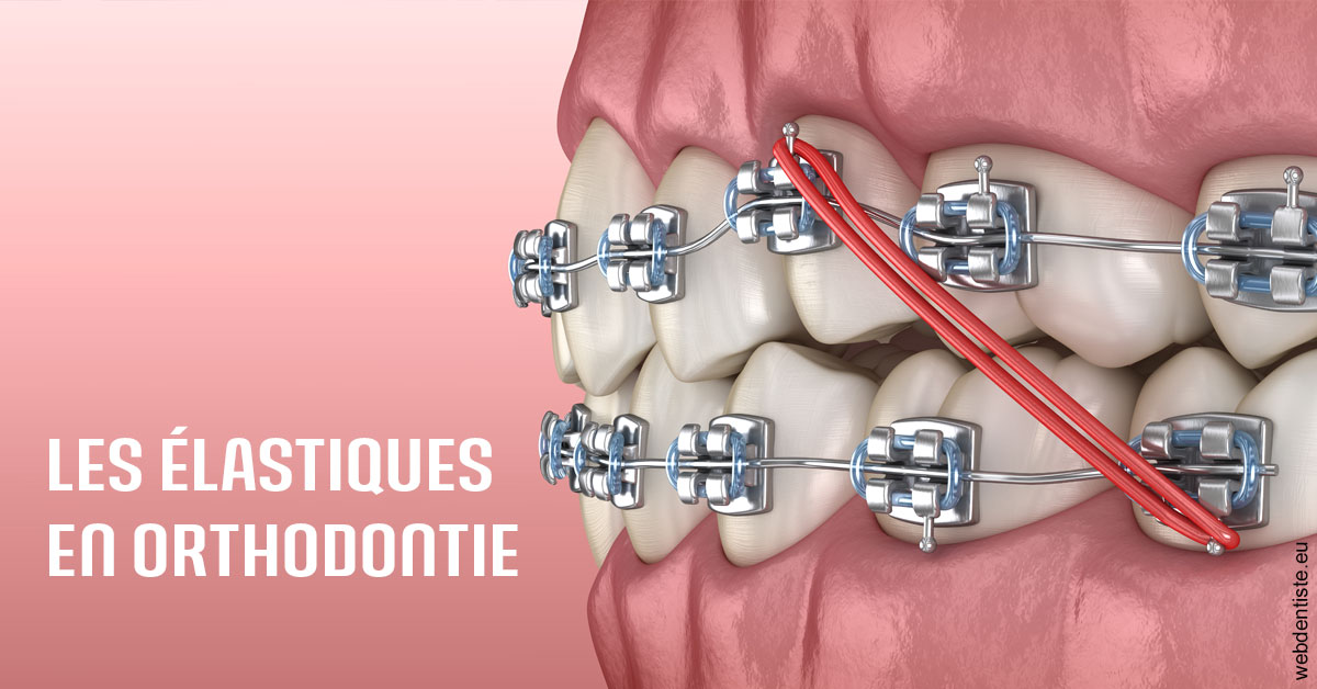 https://dr-ahr-catherine.chirurgiens-dentistes.fr/Elastiques orthodontie 2