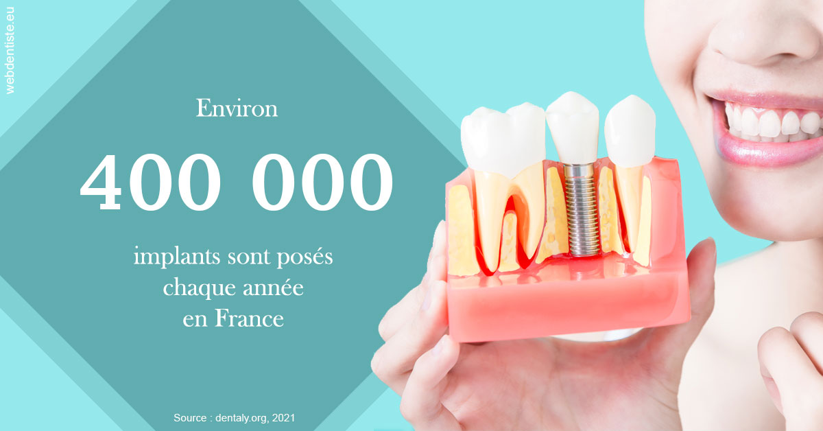 https://dr-ahr-catherine.chirurgiens-dentistes.fr/Pose d'implants en France 2